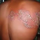 Illustration for article titled contoh obat herpes